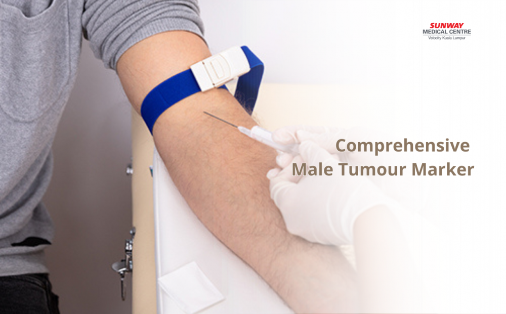Comprehensive Male Tumour Marker